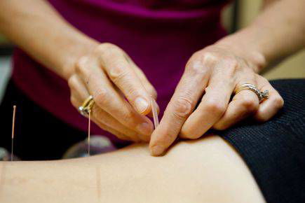 Dubbo Acupuncture & Carter Chiropractic - thumb 1