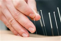 Kingscliff Acupuncture  Massage - DBD