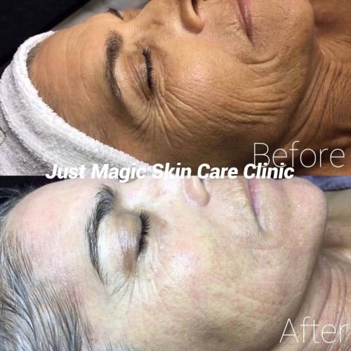 Just Magic Skin Care Clinic - thumb 16