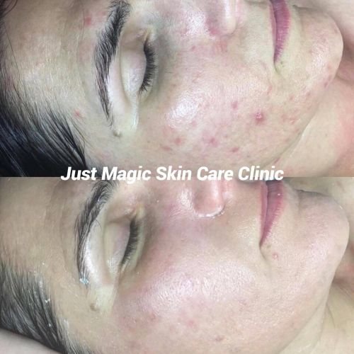 Just Magic Skin Care Clinic - thumb 18