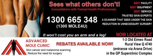 Advanced Mole Clinic - Suburb Australia