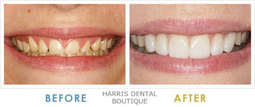 Harris Dental Boutique - thumb 3
