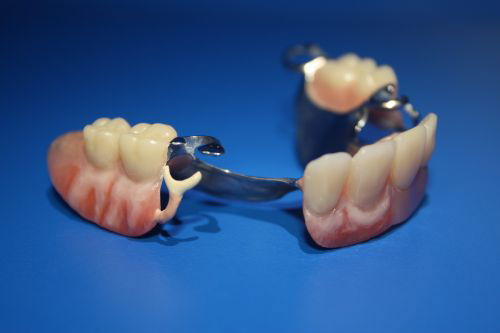 Advance Oral Denture Clinic - thumb 13