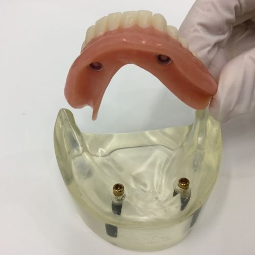 Advance Oral Denture Clinic - thumb 16