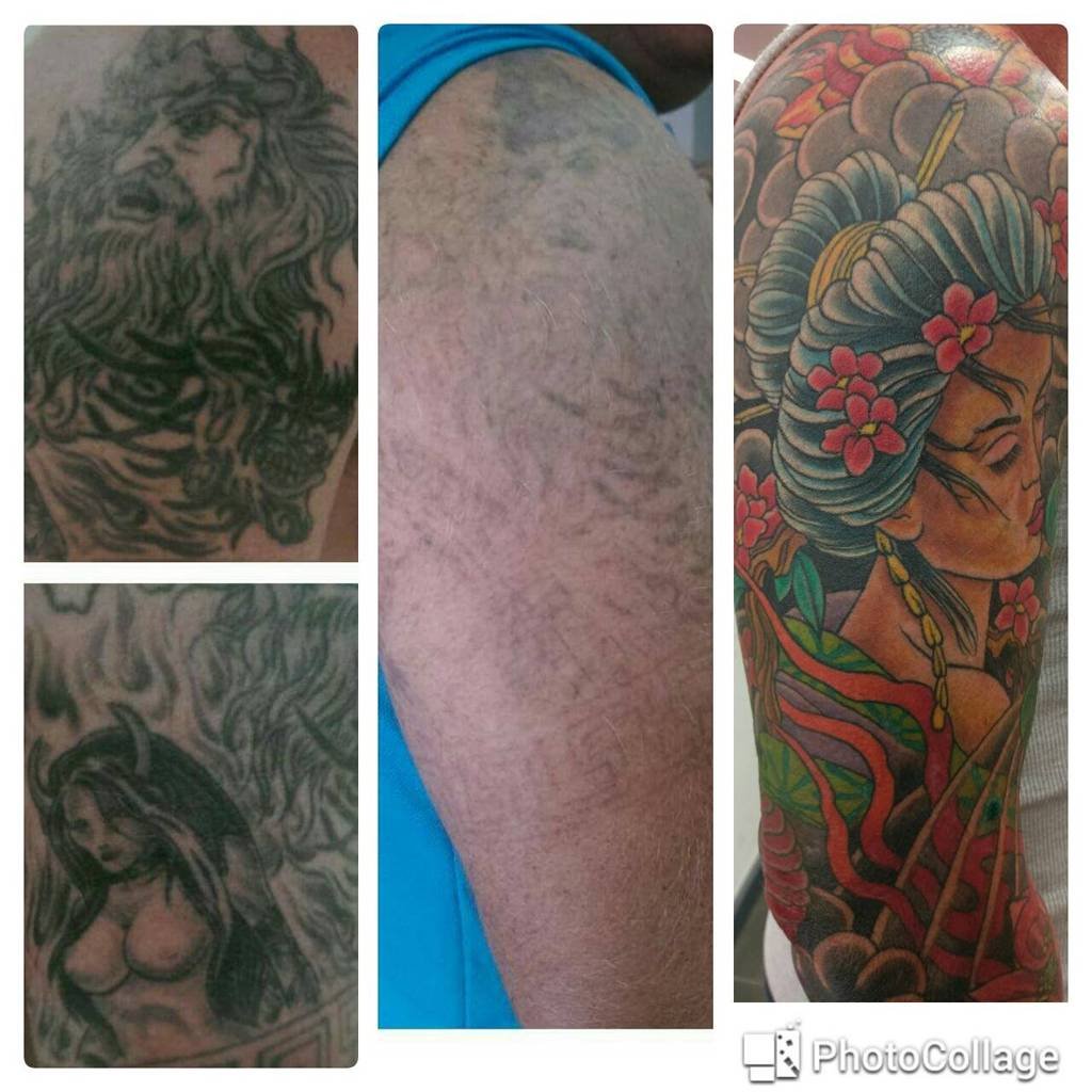 Laserpro Tattoo Removal - Click Find