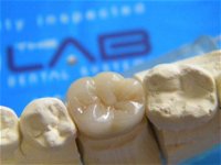The Lab Dental Systems - DBD