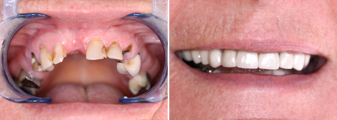 Charlestown Dental Care - Gold Coast Dentists 5