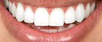 Bendigo Dentist On Hargreaves - Dentists Newcastle