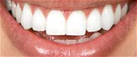 Bendigo Dentist On Hargreaves - Dentists Hobart