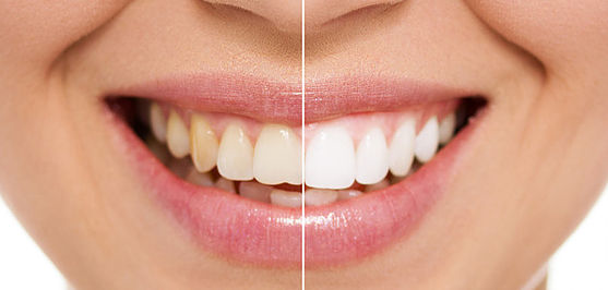 All About Smiles Ettalong - Cairns Dentist