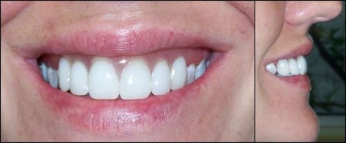 Active Denture Clinic - Gold Coast Dentists 1