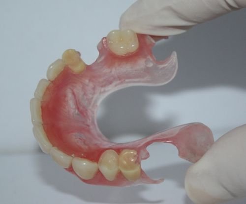 Advance Oral Denture Clinic - Gold Coast Dentists 15