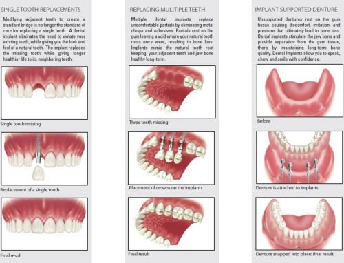 Ooralea Dental Care - thumb 3