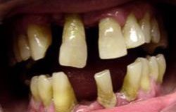 Crown Dental Surgery - thumb 1