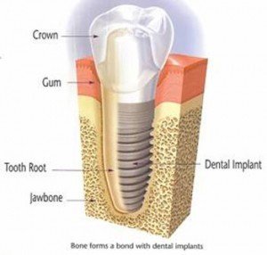 Crown Dental Surgery - thumb 2