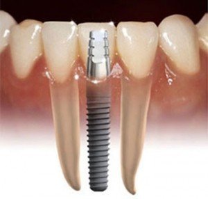 Crown Dental Surgery - thumb 3
