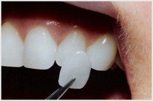 Crown Dental Surgery - thumb 5