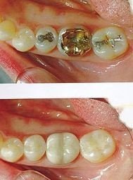 Crown Dental Surgery - thumb 7