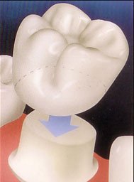 Crown Dental Surgery - thumb 9