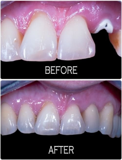 Kaleen Dental Care - thumb 2
