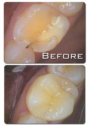 Kaleen Dental Care - thumb 3