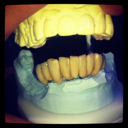 Design A Smile Dental Laboratory Technologies - thumb 1