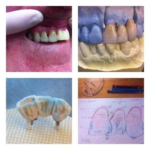 Design A Smile Dental Laboratory Technologies - thumb 2