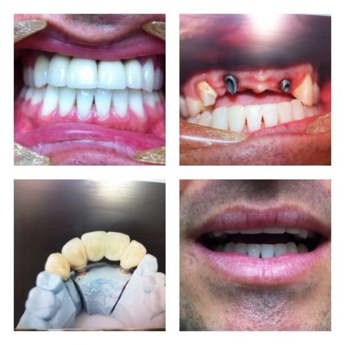 Design A Smile Dental Laboratory Technologies - thumb 3