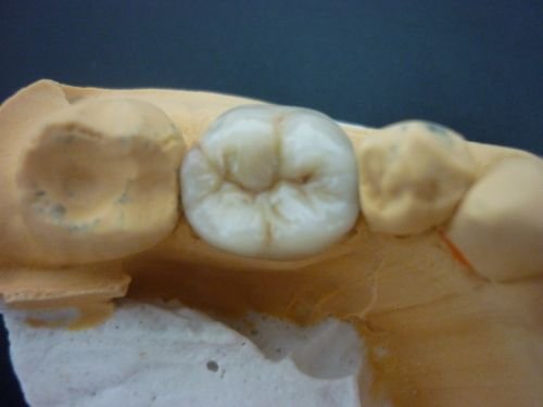 M A Dental Ceramics
