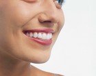 A Better Smile Dental - Cairns Dentist