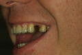 A Better Smile Dental - thumb 1