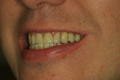 A Better Smile Dental - thumb 2