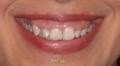 A Better Smile Dental - thumb 3