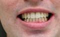 A Better Smile Dental - thumb 6