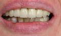 A Better Smile Dental - thumb 8