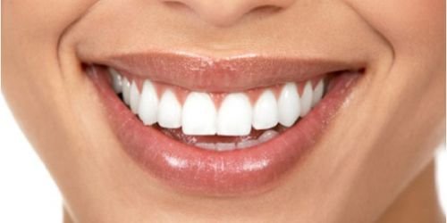 Smile Professionals - Reliable Cosmetic Dentistry in Perth - Cairns Dentist