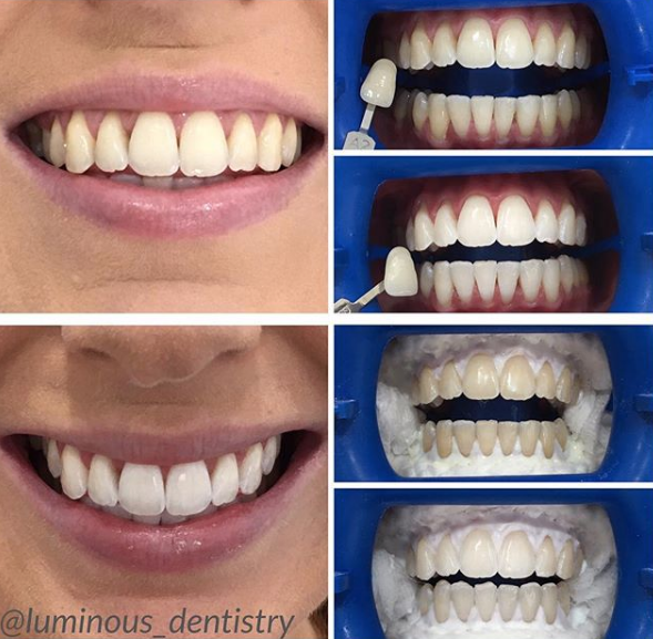 Luminous Dentistry - thumb 44