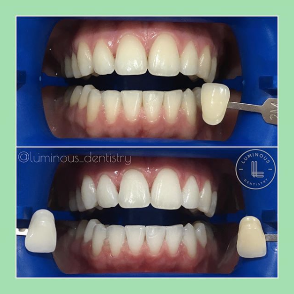 Luminous Dentistry - thumb 36