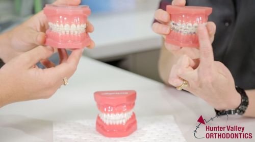 Hunter Valley Orthodontics - Cairns Dentist