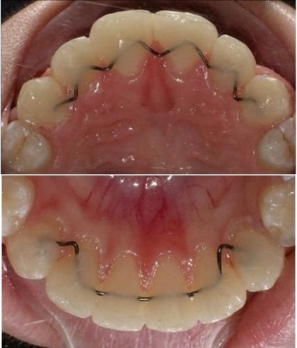 Hunter Valley Orthodontics - thumb 4