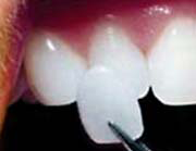 Hermitage Dental - thumb 6