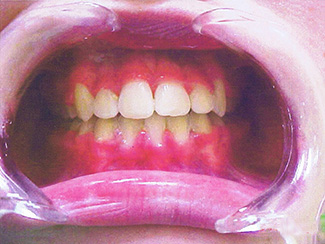 Central Gosford Orthodontics - thumb 2