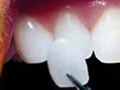 Hermitage Dental - thumb 16