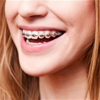 Cairns Specialist Orthodontists - Dentists Australia