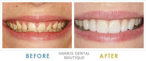 Harris Dental Boutique - Cairns Dentist 4