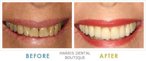Harris Dental Boutique - Gold Coast Dentists 5