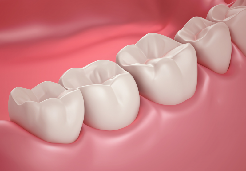 Coastal Dental Implants - Cairns Dentist 0