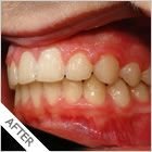 Smiling Wide Orthodontics - Cairns Dentist 3