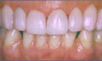 Cairns Dental Anaesthetic Centre - thumb 14