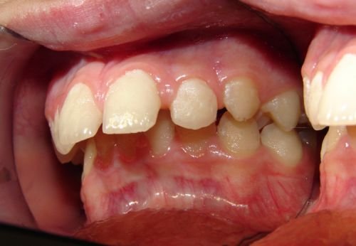 Smiling Wide Orthodontics - Dentists Hobart 6